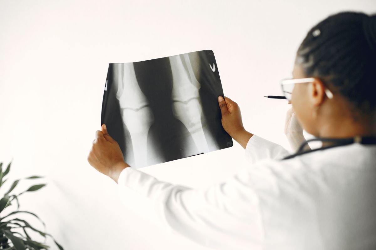PMCF – Cemented Mobile Bearing Total Knee Replacement (Class III Implant) clinical research