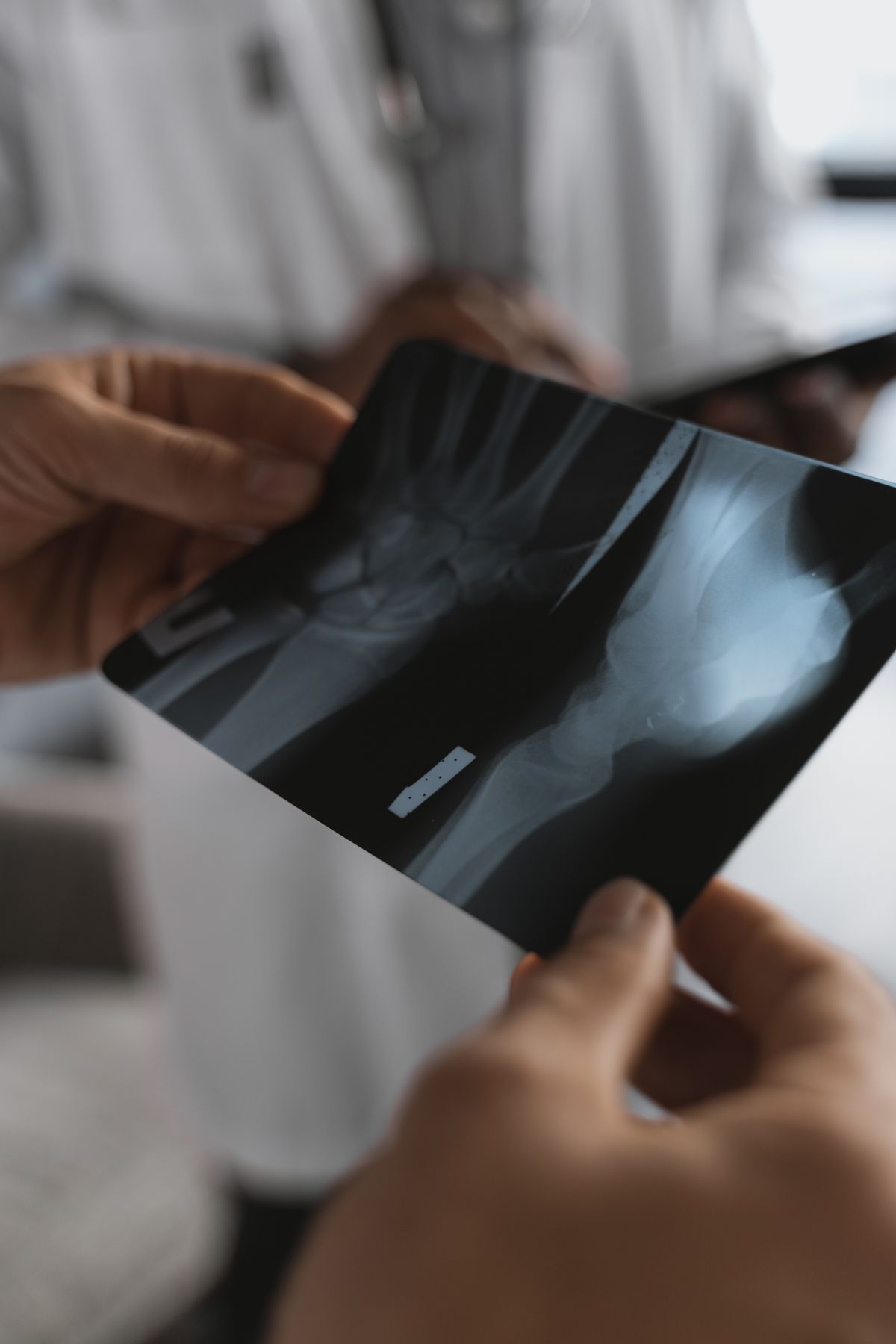 Spinal Implant Systems – EU MDR PMCF Study (Class IIb) clinical research