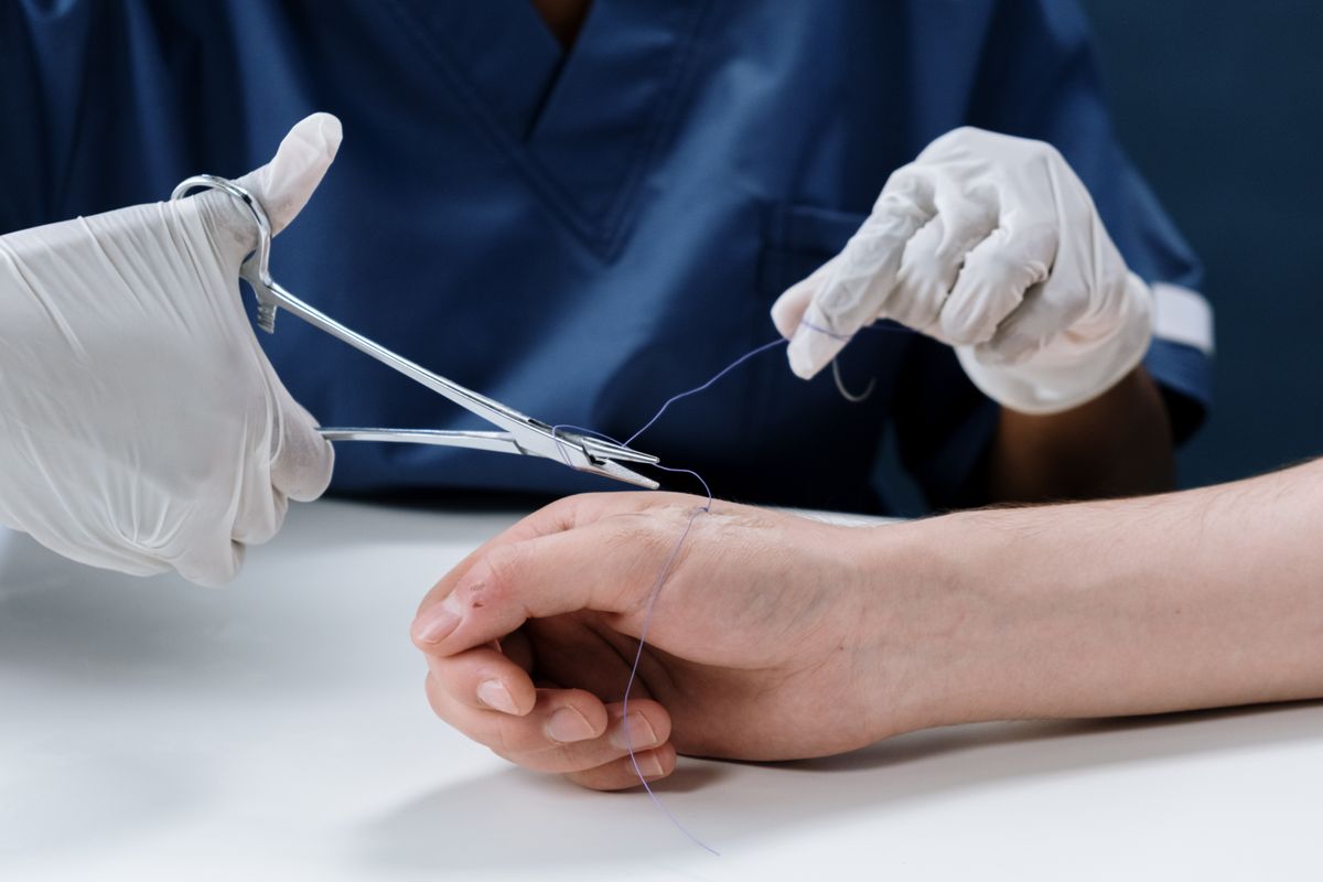 PMCF – Non-Absorbable Synthetic Surgical Sutures (Class IIb) clinical research