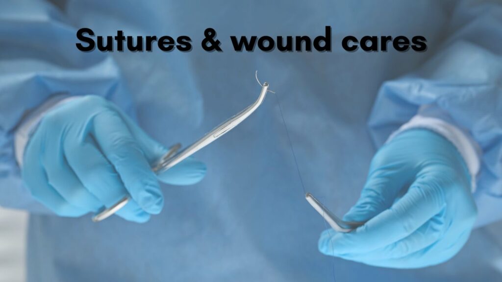 sutures